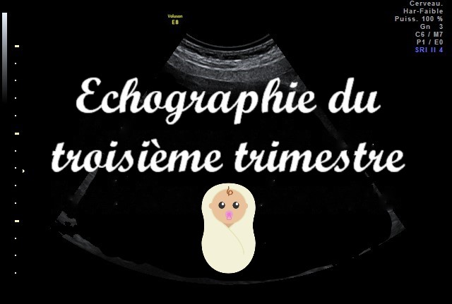 Echographie Du Troisieme Trimestre P Tite Bouille